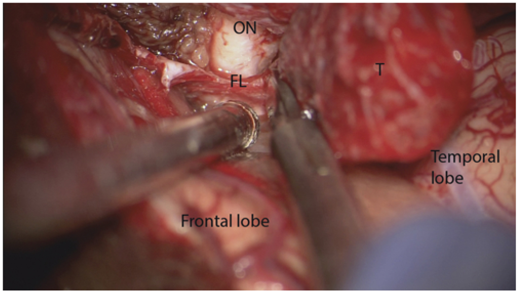 FIG. 1.