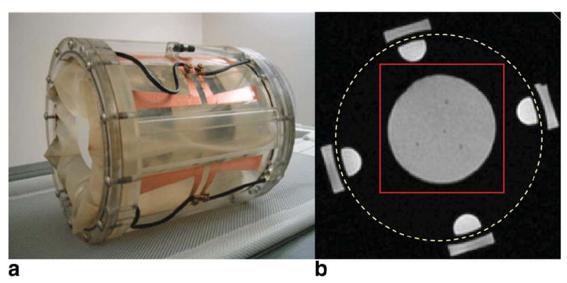 FIG. 3