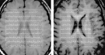 <sc>fig</sc> 2.