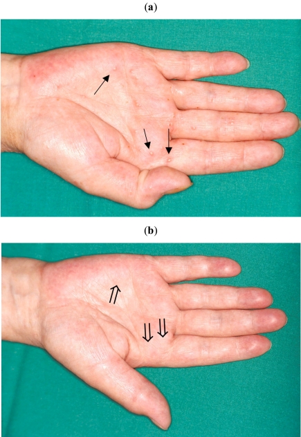 Fig (1)