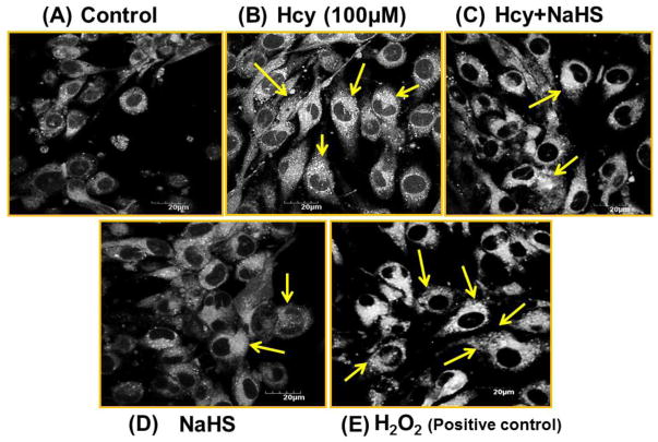 Fig. 12