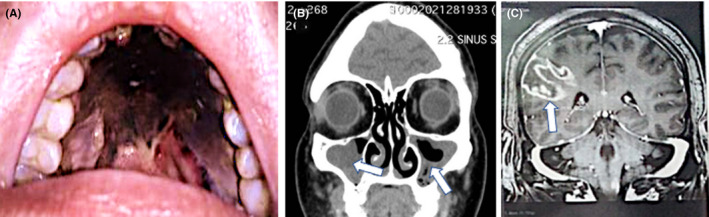 FIGURE 1