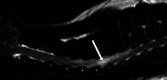 Fig 3.