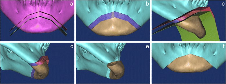 Fig. 4