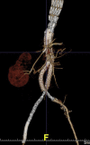 Fig 3