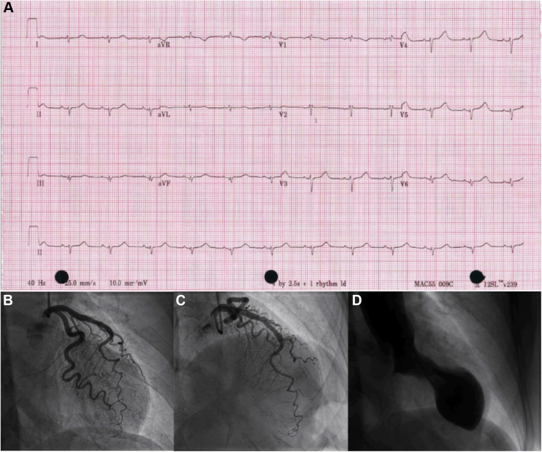 Figure 1