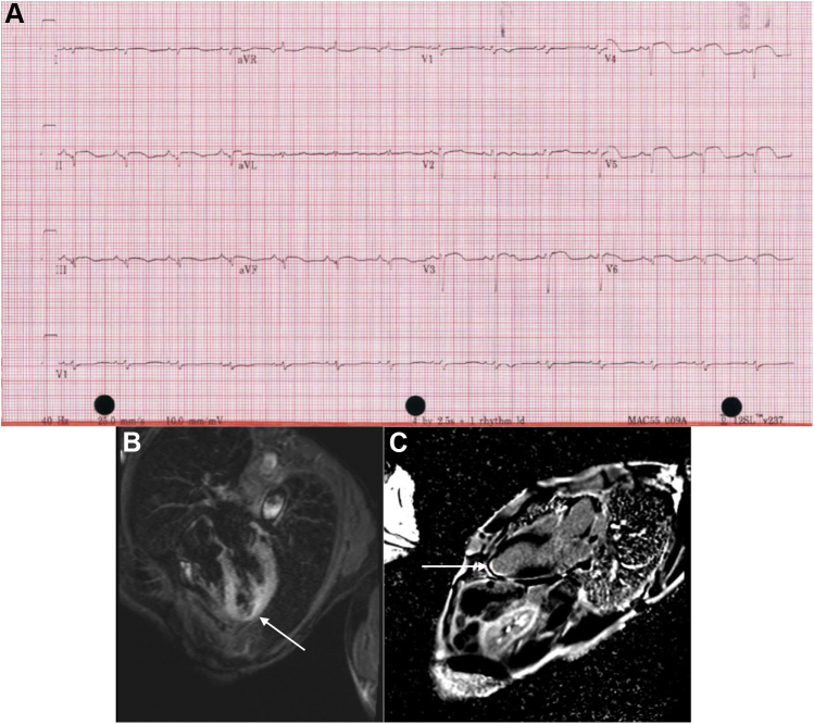 Figure 2