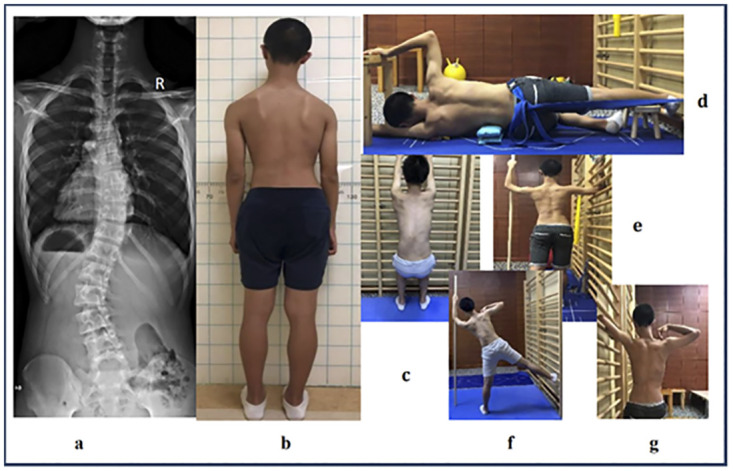 Fig 3