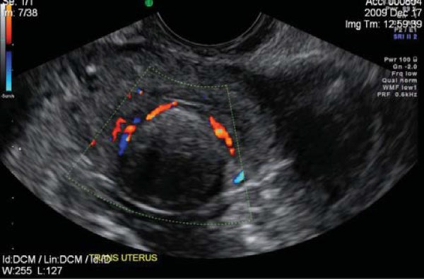 Fig. 9