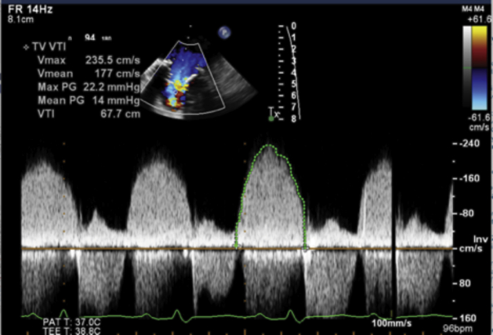 Figure 3