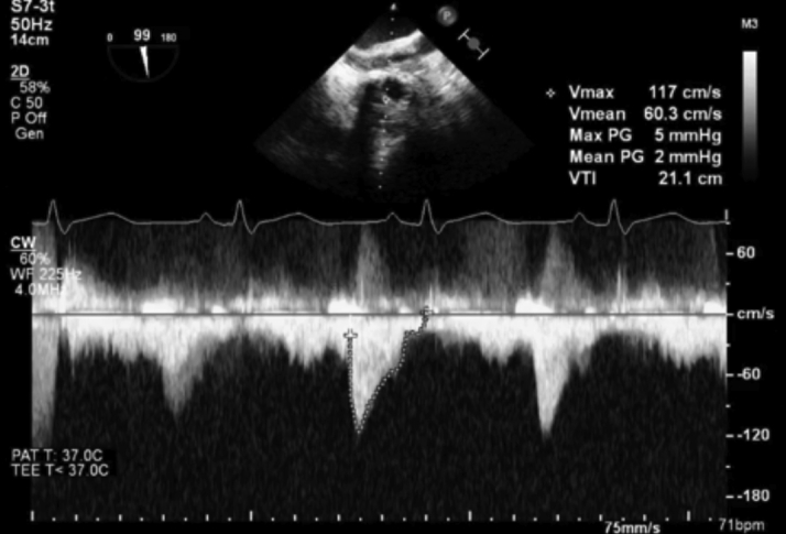 Figure 7