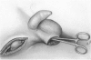 102