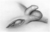 98