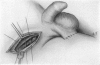 103