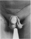 105