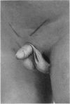 105