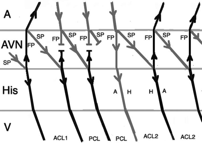 FIGURE 11