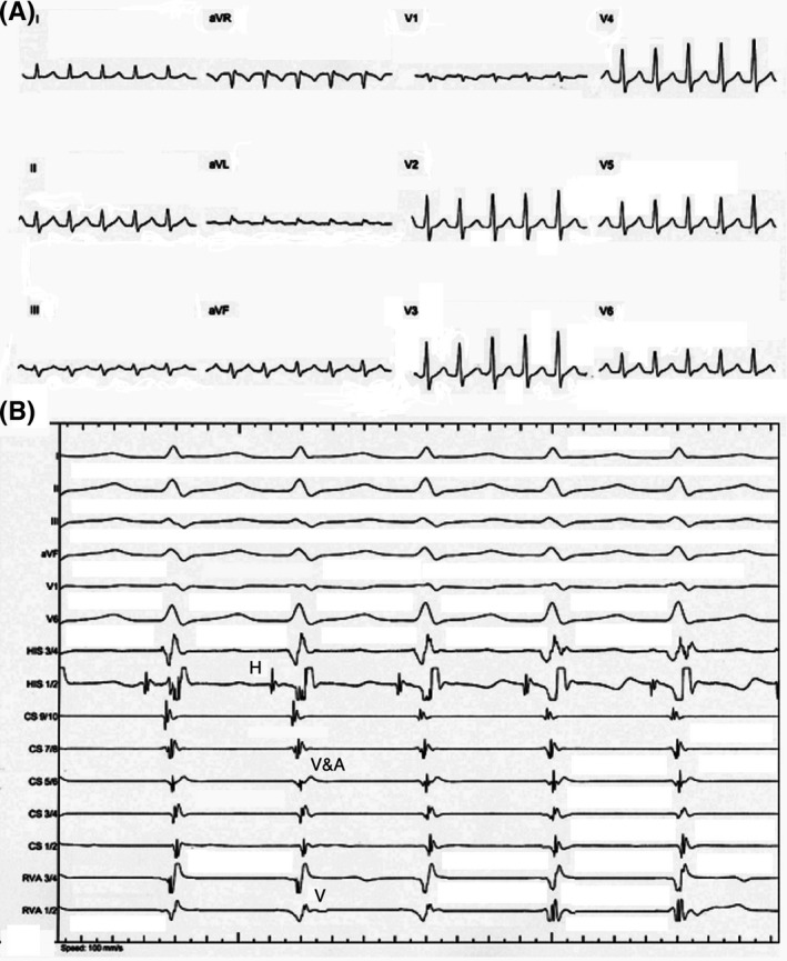 FIGURE 1