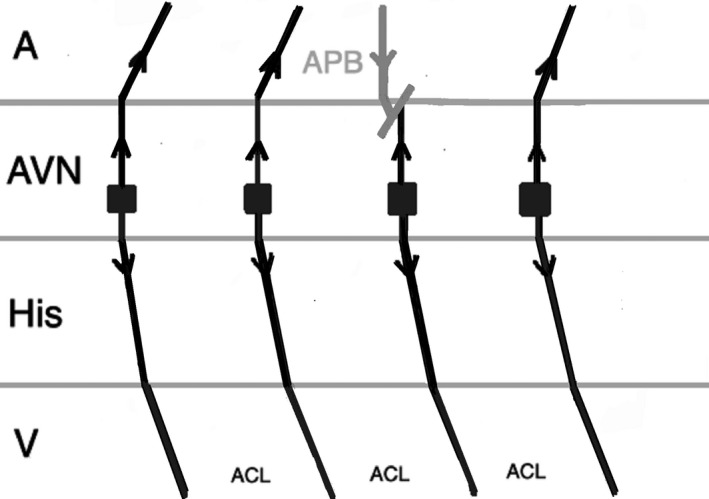 FIGURE 3