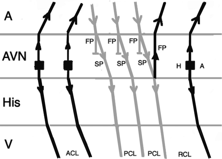 FIGURE 12