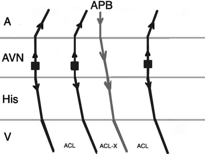 FIGURE 4