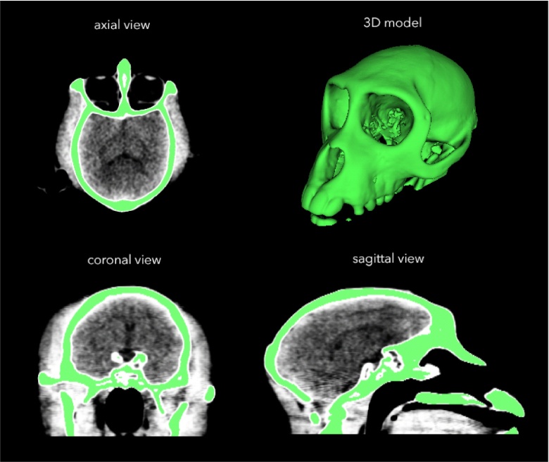 Fig. 2