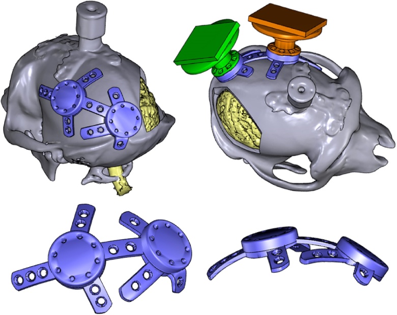 Fig. 9