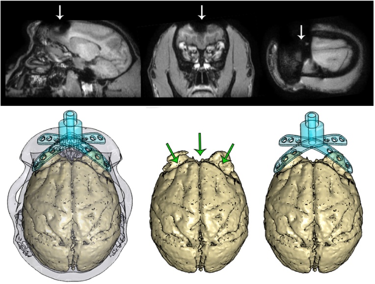 Fig. 15