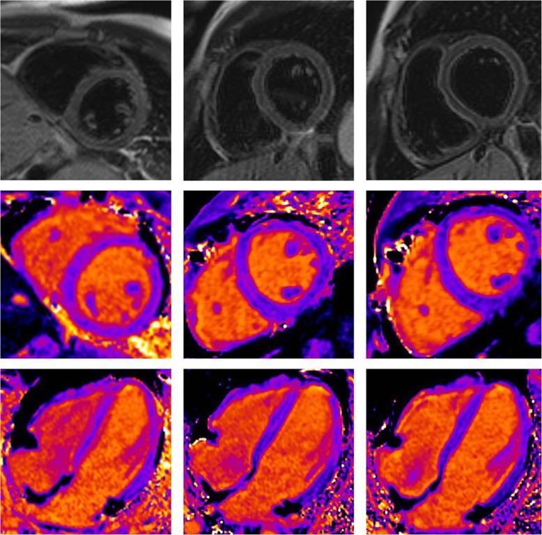 Fig. 1