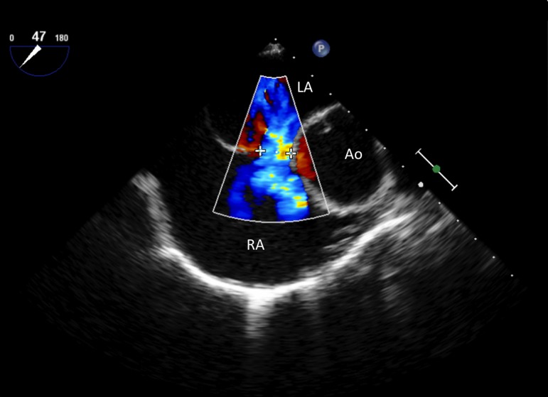 Figure 4