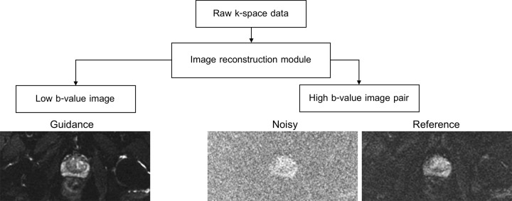 Schematic flow of image preprocessing steps (details are in Appendix E3 [supplement]). Raw k-space data from one diffusion-weighted (DW) scan is reconstructed to produce three types of images: guidance (low b-value DW image reconstructed with all available averages), noisy (high b-value DW image reconstructed using two averages), and reference (high b-value DW image, reconstructed using 16 averages).