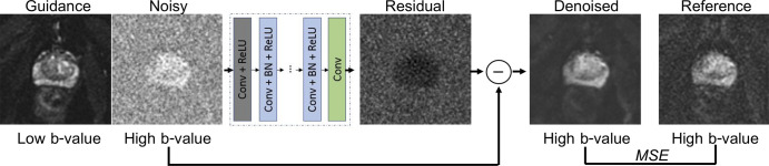 Denoising convolutional neural network (DnCNN) design. Guidance image is only used in the guided DnCNN. Residual image is estimation of noise, which is subtracted from the noisy image to produce the denoised image. Mean squared error (MSE), calculated between the denoised image and the reference image, is used as loss function. BN = batch normalization, Conv = convolutional, ReLU = rectified linear units.