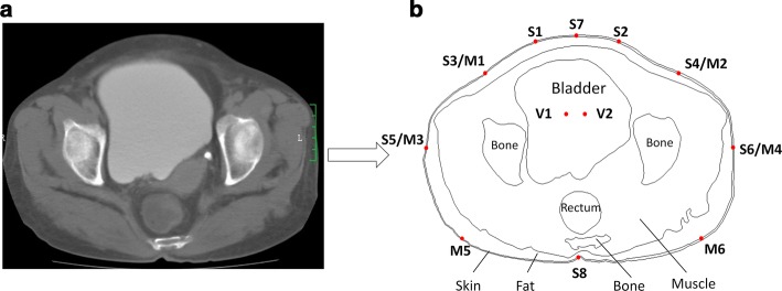 Fig. 1