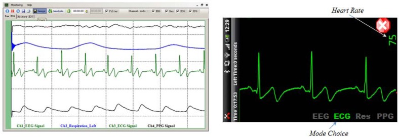 Figure 12.