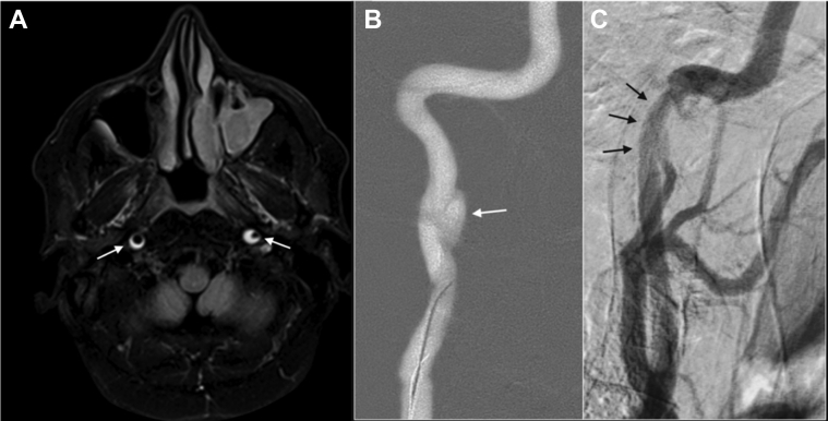 Fig 2