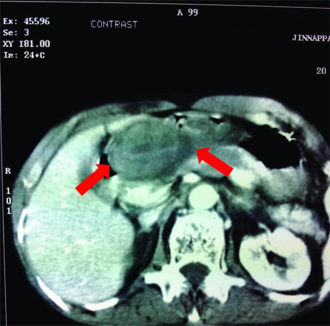 [Table/Fig-1]: