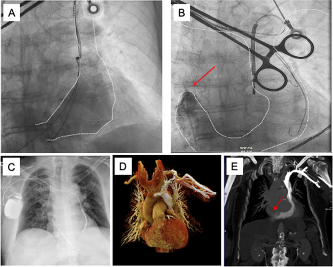 Fig. 5