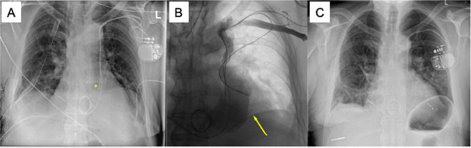 Fig. 4
