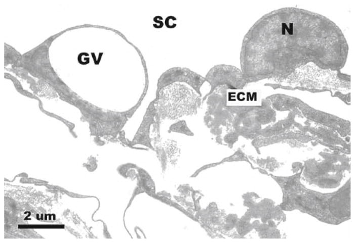 Fig. 12