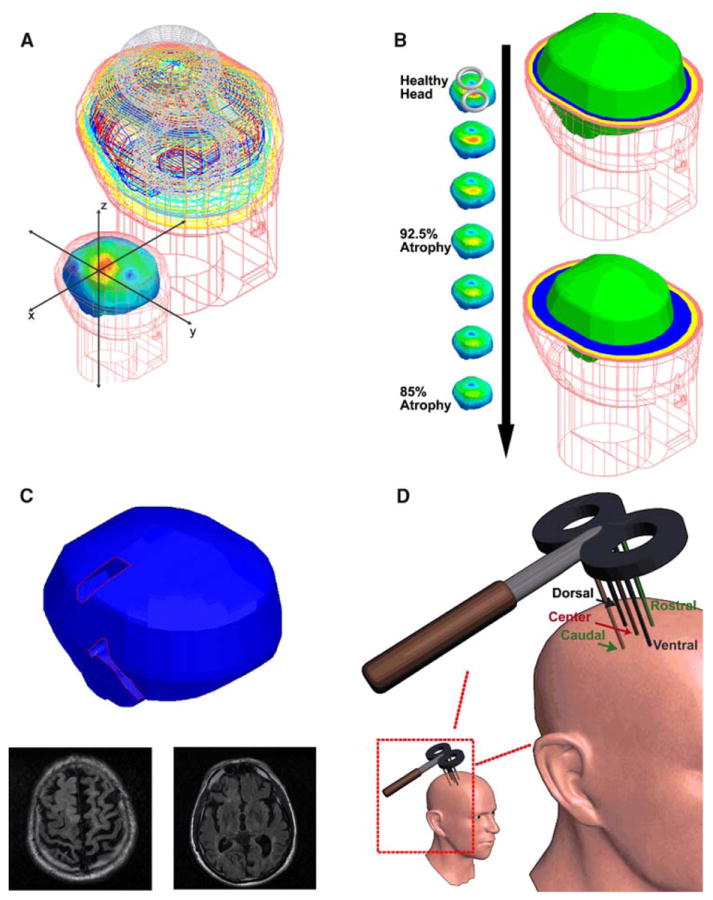 Fig. 1