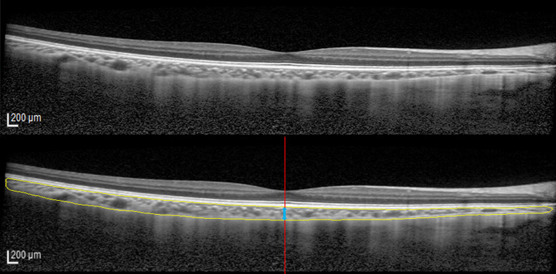 Fig. 1