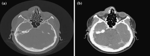 Fig. 3