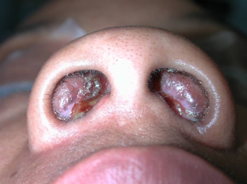 Fig. 1