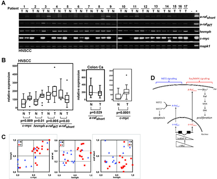 Figure 6: Expression of c-myc, hnRNP H, and a-raf isoforms in carcinomas and adjacent normal tissues