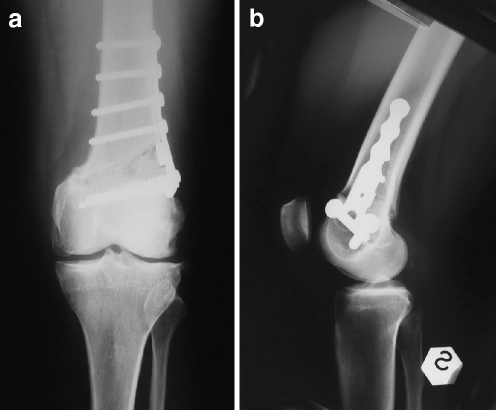 Fig. 10