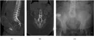 Figure 12.