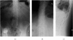 Figure 11.