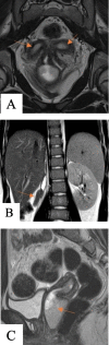 Fig 5