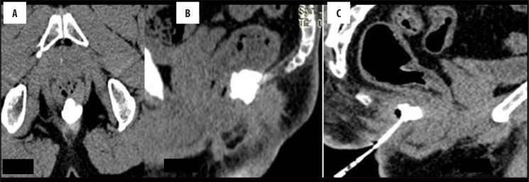 Figure 14