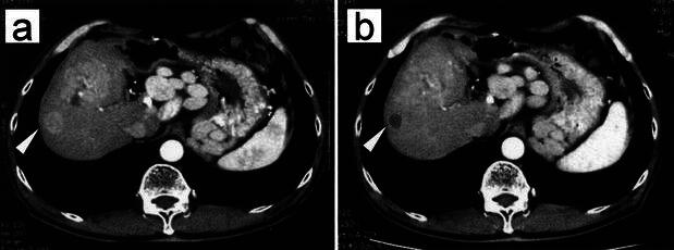 Fig. 3a, b.